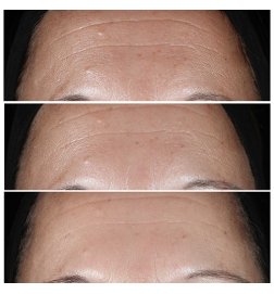 Smart Clinical Repair Serum - Faltenkorrektur-Serum